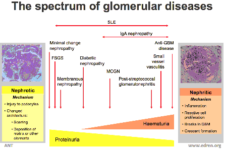 glomerulonephritis diétája