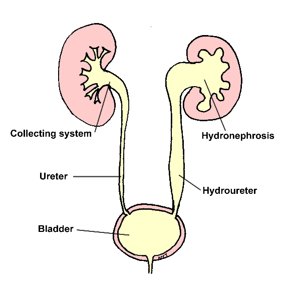 Infectiile tractului urinar – Pasdur